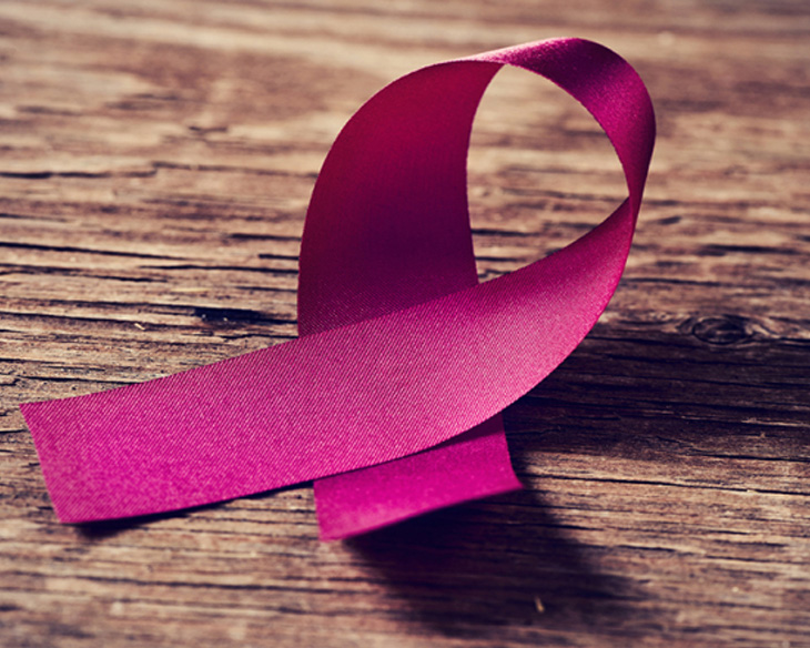 健康・医学 Preneoplasia of the Breast Breast Cancer Treatment During Pregnancy (PDQ®) - PDQ Cancer